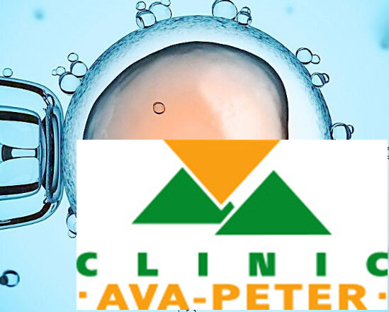 试管婴儿诱导排卵的原理 试管婴儿诱导排卵的原理