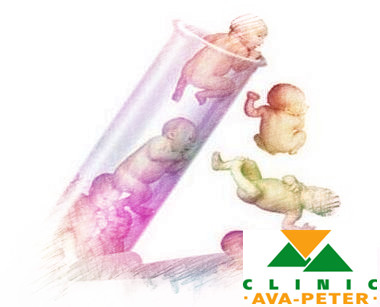 试管婴儿成功率会受哪些影响?