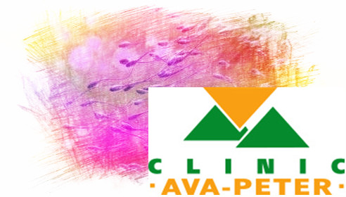 真神奇!科学家发现精子遭遇困境时也会团结合作