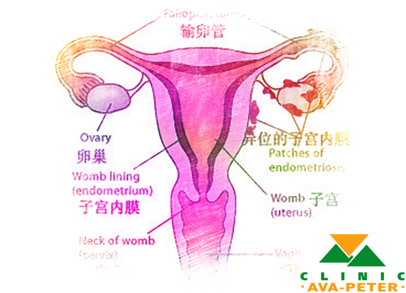 子宫内膜薄难怀孕，可以做试管婴儿吗？