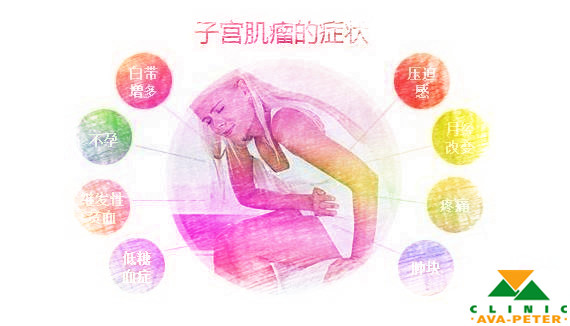 刘畊宏曝妻子曾患子宫肌瘤,屡次尝试才艰难生下小泡芙! 子宫肌瘤的症状