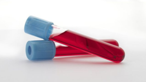 验血可以预防哪些? 验血可以预防哪些?