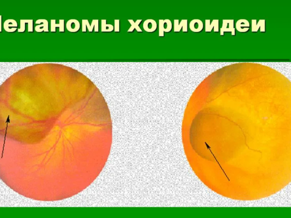 做俄罗斯试管前为什么要检查甲状腺功能呢？